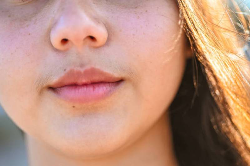 Epilation Définitive électrique pour un résultat durable à Pierrefeu-du-Var Epilation Définitive électrique pour un résultat durable à Pierrefeu-du-Var
