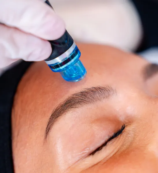 HydraFacial : Le soin expert nouvelle génération pour une peau éclatante et parfaitement hydratée proche de Toulon