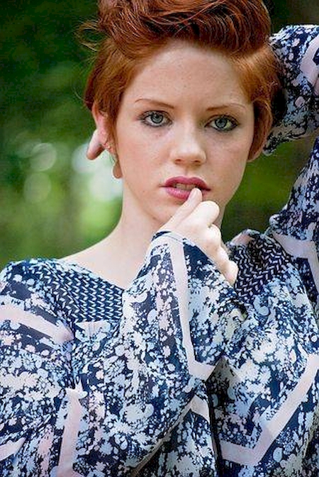 Notre zone d'activité pour ce service Traitement des cicatrices et vergetures par microneedling