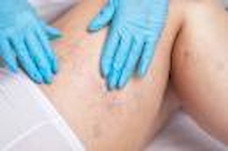 Nos prestations sur le secteur de vers Le Lavandou et Bormes-les-Mimosas